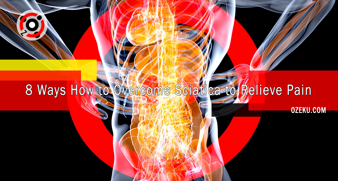 8 Ways How to Overcome Sciatica to Relieve Pain